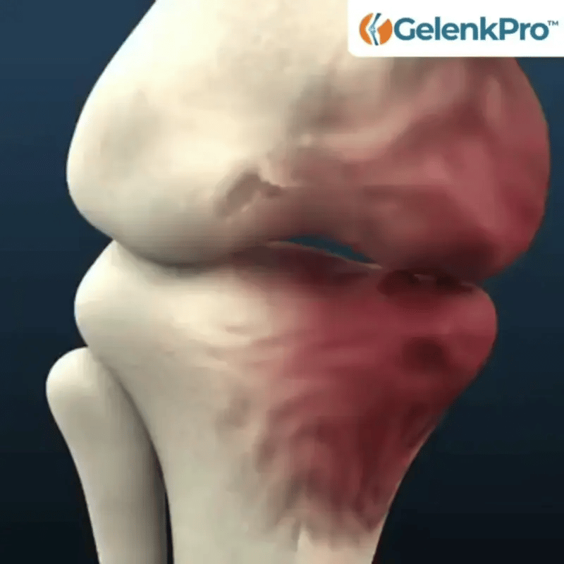 GelenkPro™ | Hyaluron-Creme gegen Gelenkschmerzen