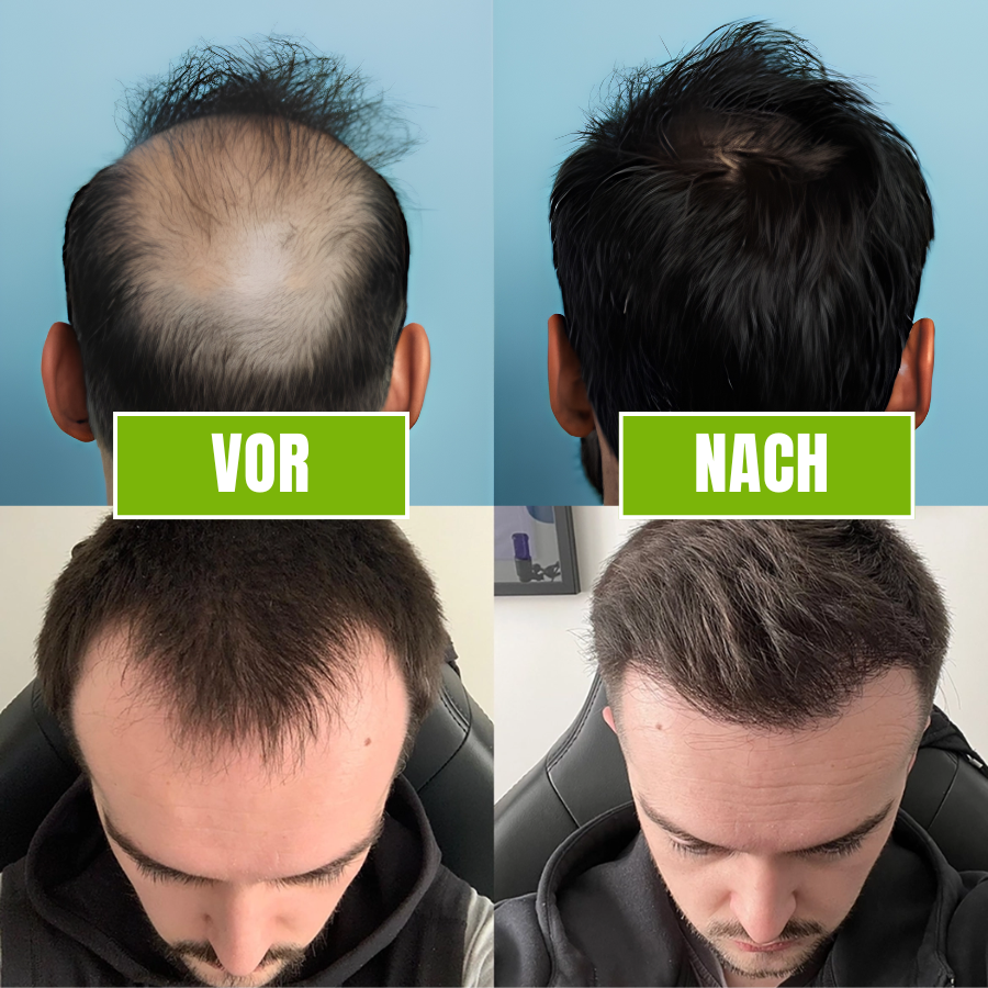 HairMax™ | Micro-Infused Hair Technology