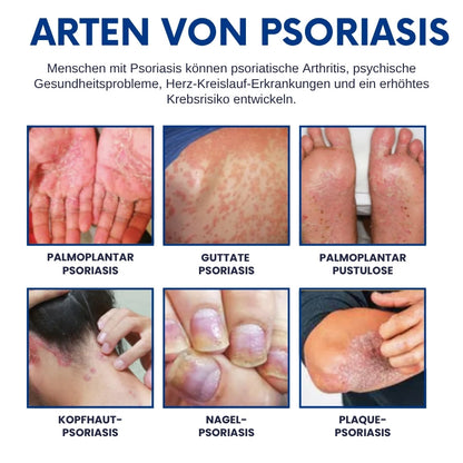 CuraSkin™ | Psoriasis- und Ekzem-Creme