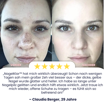 GlanzTon™ | Getönte, farbkorrigierende Gesichtscreme mit Lichtschutzfaktor (SPF)