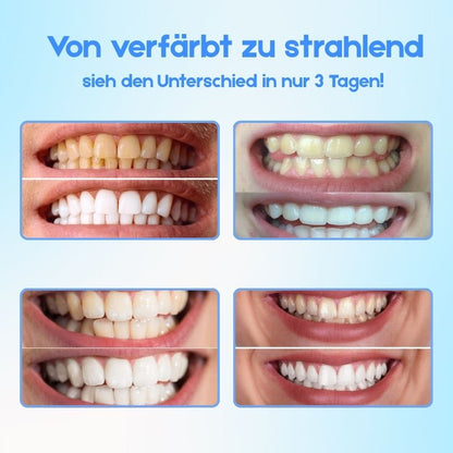 WeißGlanz™ | Zahnaufhellungsstift