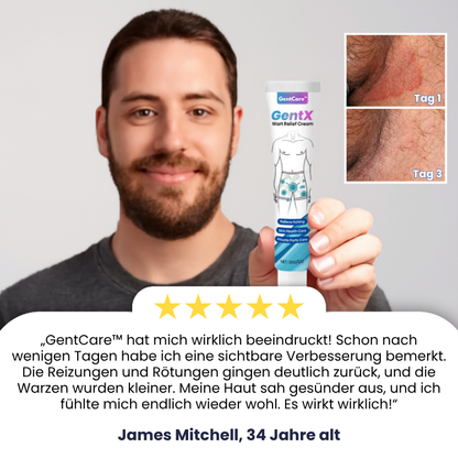 GentCare™ | Creme zur Linderung von Genitalwarzen