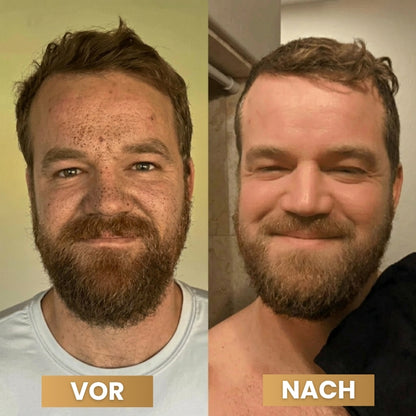 PeelShot™ | Fortschrittliches Poren-reinigendes Exfoliationssystem