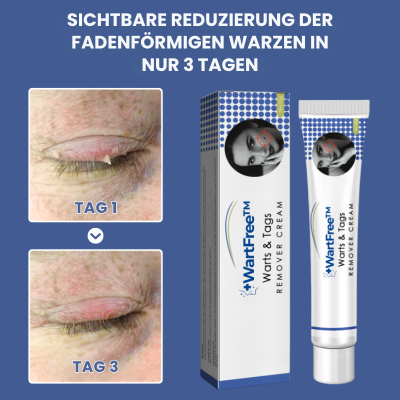 WartFree™ | Lösung zur Entfernung von Stielwarzen