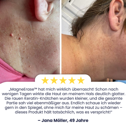 MagneErase™ | Magnesium Hauterneuerungs-Creme