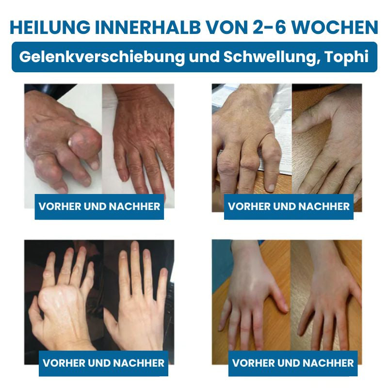 ReparaJoint™ | Stoppe Arthrose sofort und hole dir in nur 7 Tagen 95 % deiner Beweglichkeit zurück