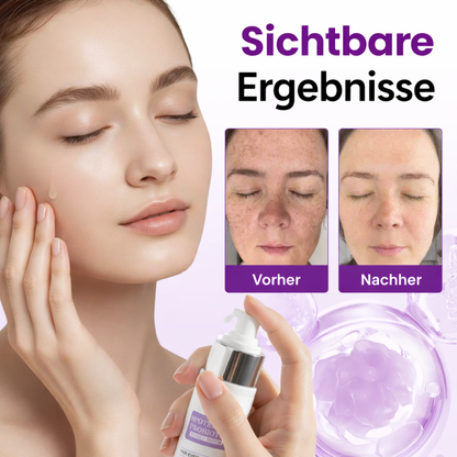 SpotErase™ | Tiefenpflege für das Gesicht