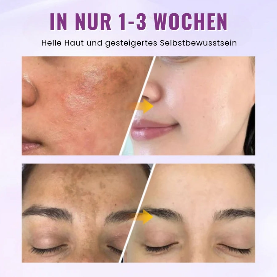 GlowGenix™ | Niacinamid Aufhellendes Sommersprossen Serum