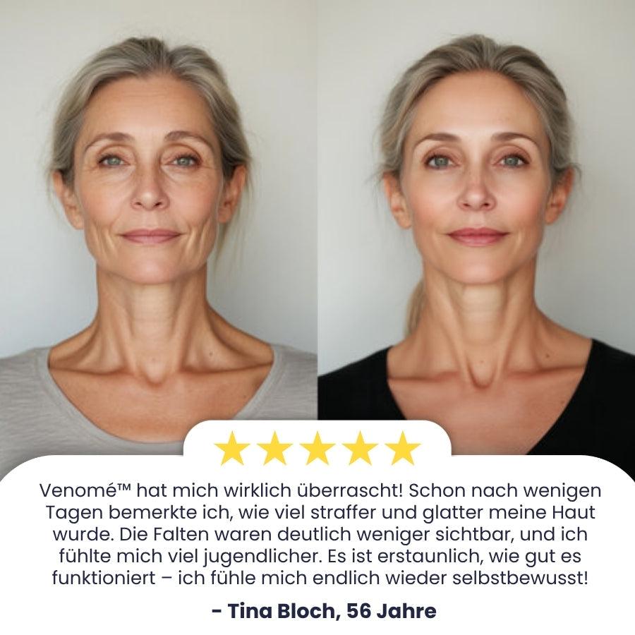 Venomé™ | Botox Faltenstraffende Creme