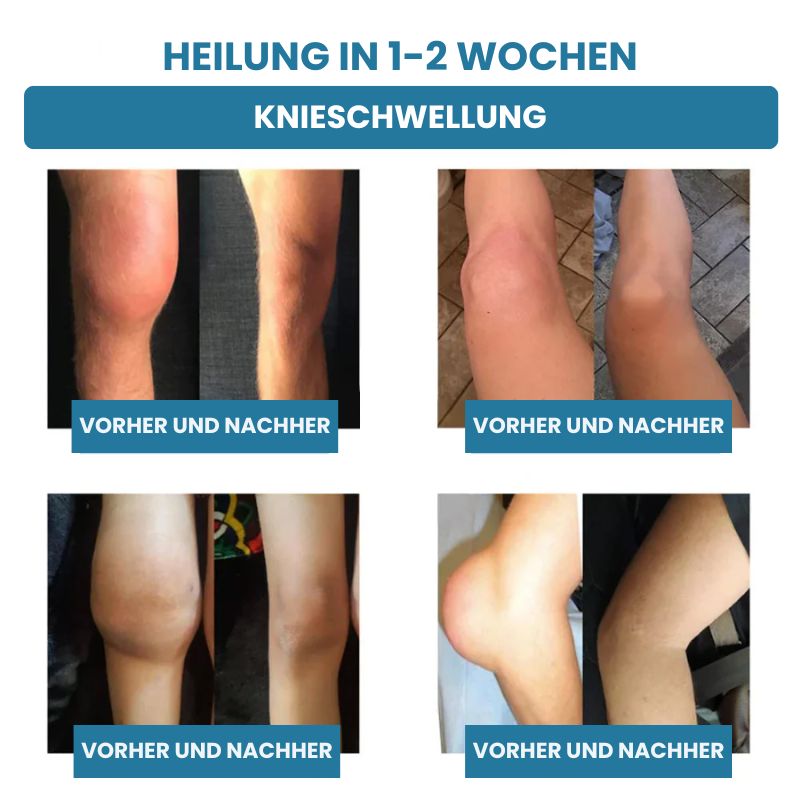 GelenkPro™ | Hyaluron-Creme gegen Gelenkschmerzen