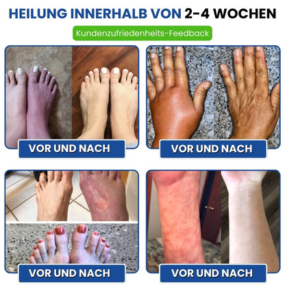 Nurovita™  | Natürlicher Creme für Neuropathie-Komfort