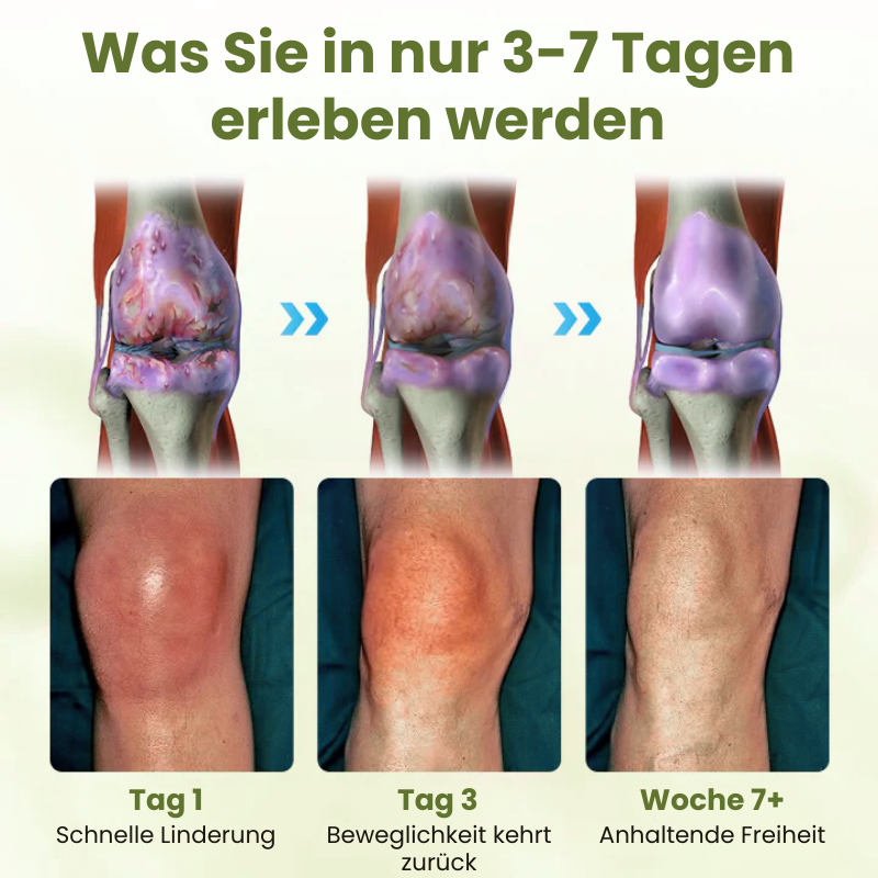 StabiKnee™ | Magnetische Kniebandage