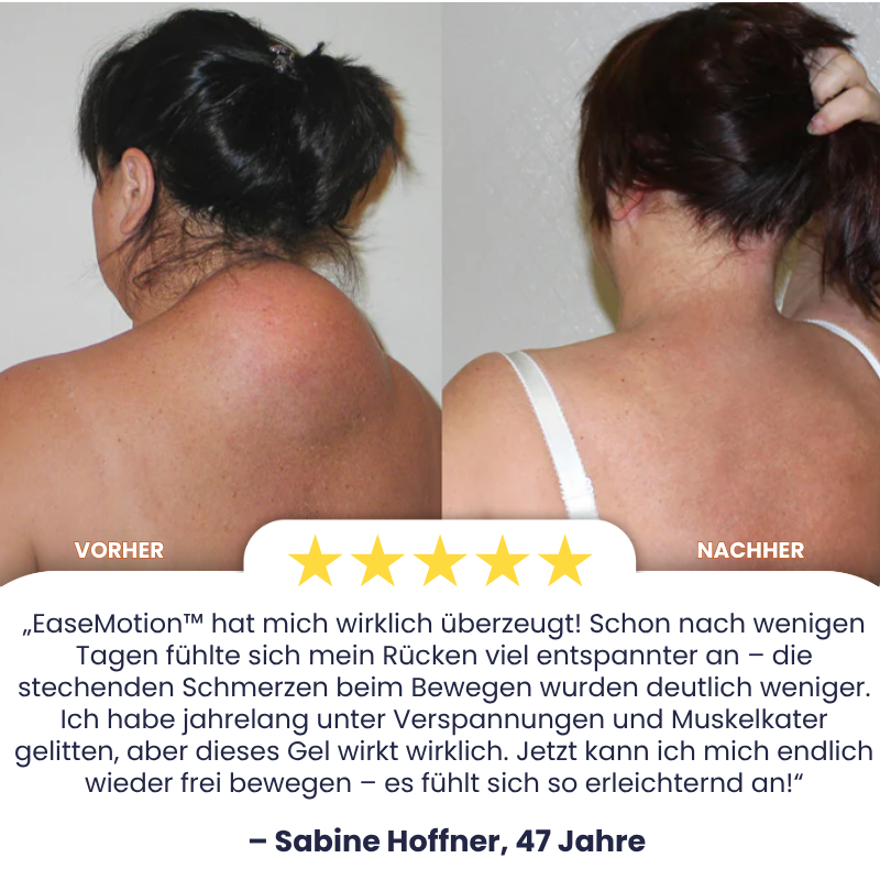EaseMotion™ | Curcumin-Schmerzlinderungsgel