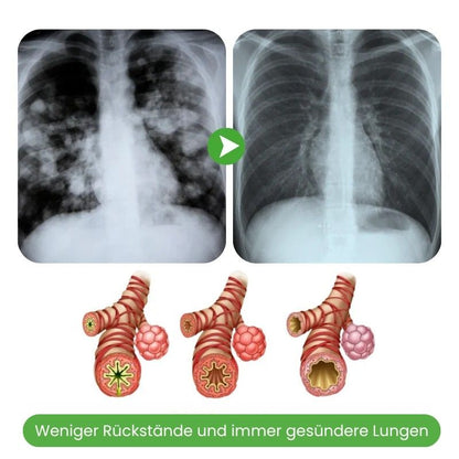 LungenRein™ Mullein Inhalator Pen | Atme tiefer und befreie deine Lungen in nur 7 Tagen