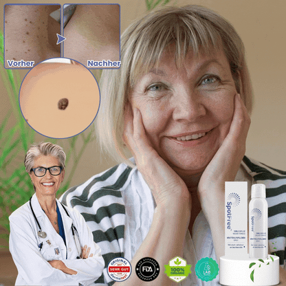 SpotFree™ | Serum gegen Warzen