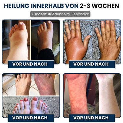 NervoVital™ | Nervenschmerz-Linderungscreme