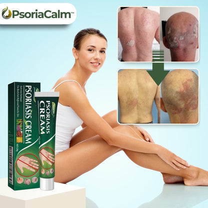 PsoriaCalm™ | Ekzem- und Psoriasis-Creme