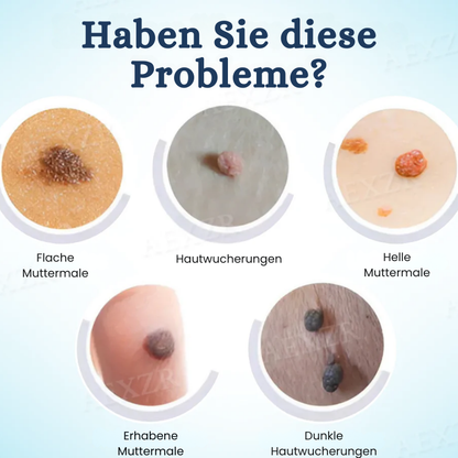 TagGone™ | Tags- und Muttermalentferner