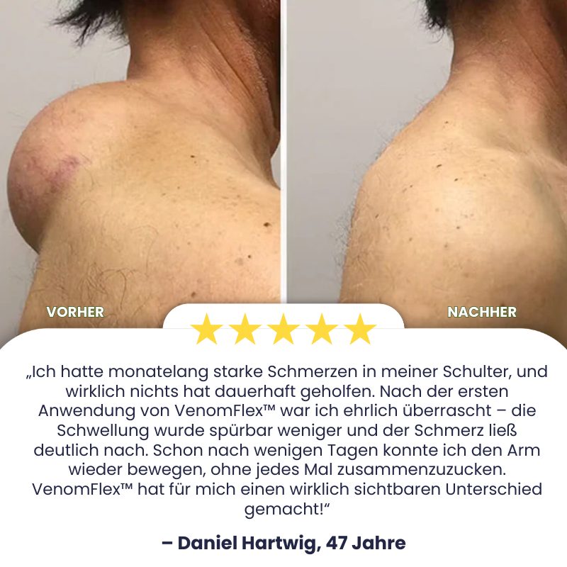 VenomFlex™ | Schmerzcreme mit gereinigtem Bienengift