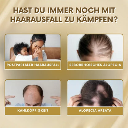 VitaGrow™  | Biotin Haarwuchs-Spray