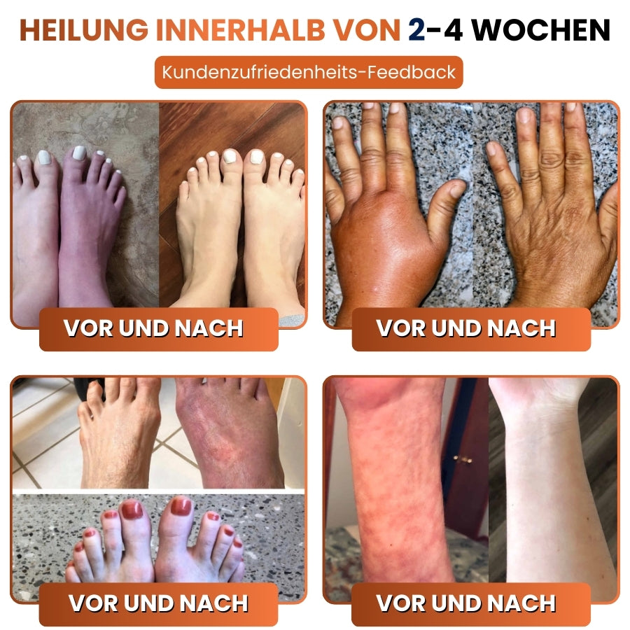 ReNerva™ | Vitamin-B-Komplex-Tropfen