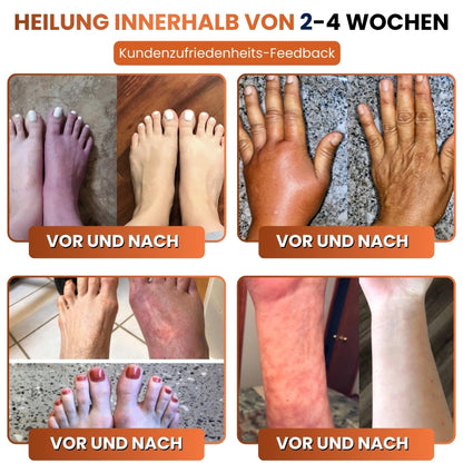ReNerva™ | Vitamin-B-Komplex-Tropfen