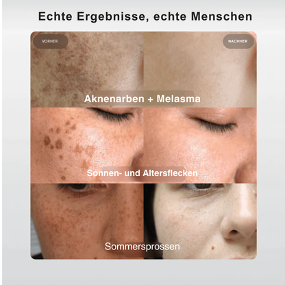 SpotBright™ | Tiefenpflege für das Gesicht