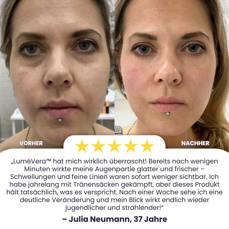 LuméVera™ | Eye-Lift-Creme