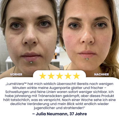 LuméVera™ | Eye-Lift-Creme