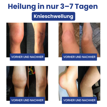 JointHeal™ | Gelenkpflege-Gel-Roller