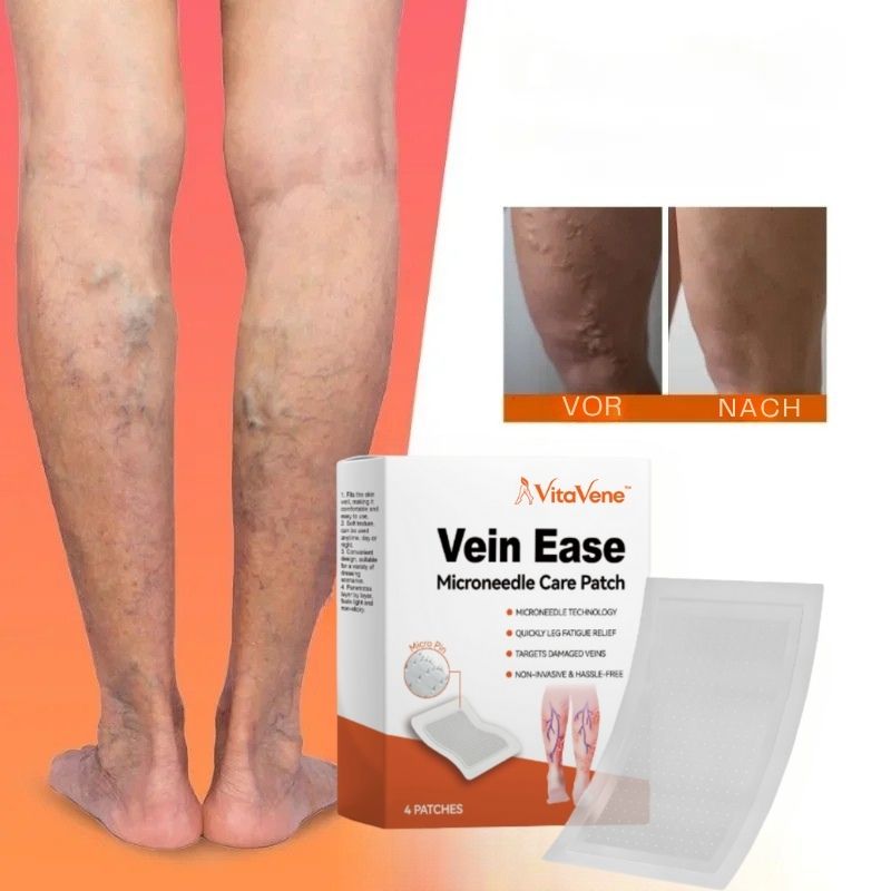 VitaVene™ | Natürliche Venenpflege-Kapseln