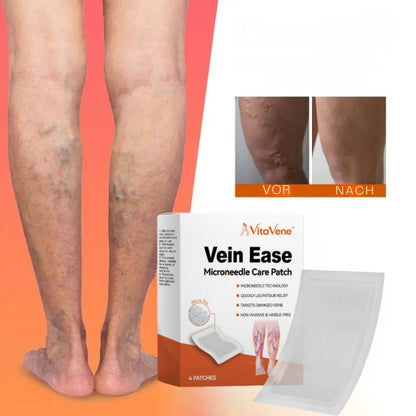 VitaVene™ | Natürliche Venenpflege-Kapseln