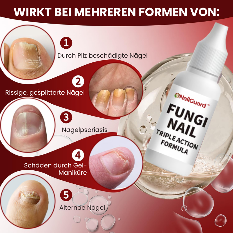 NailGuard™ | Behandlung von Fußnagelpilz