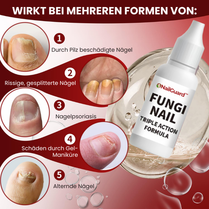 NailGuard™ | Behandlung von Fußnagelpilz