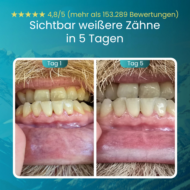 OralGuard™ | Remineralisierender Kaugummi