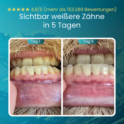 OralGuard™ | Remineralisierender Kaugummi