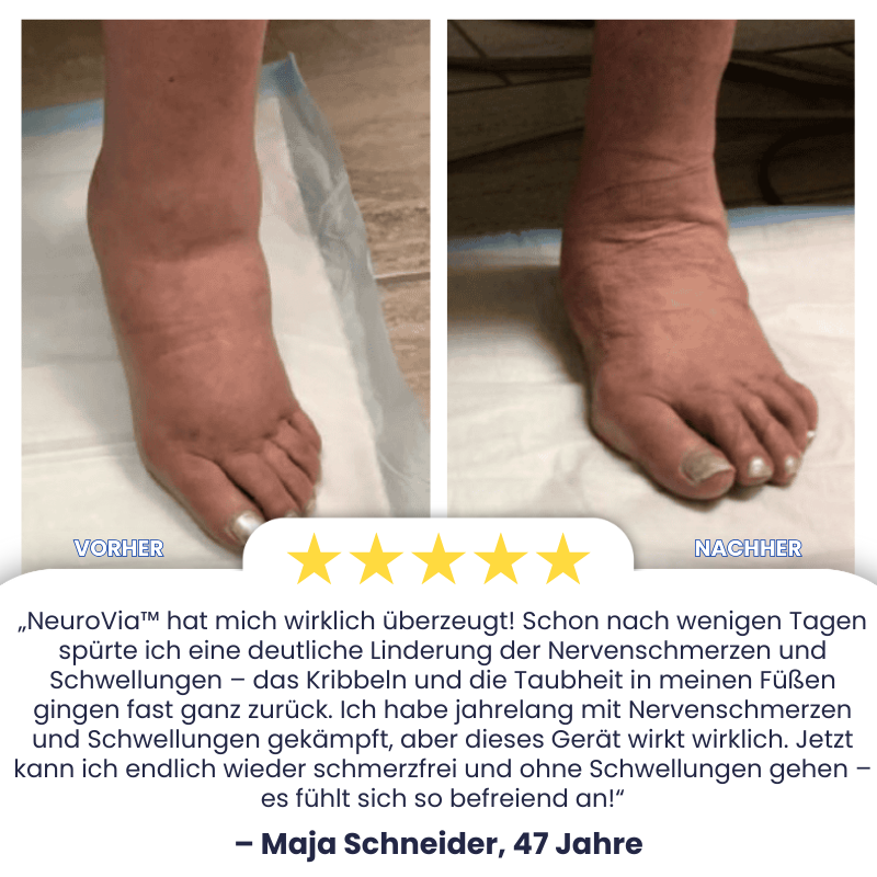 NeuroVia™ | Neuromuskuläre Elektrostimulation