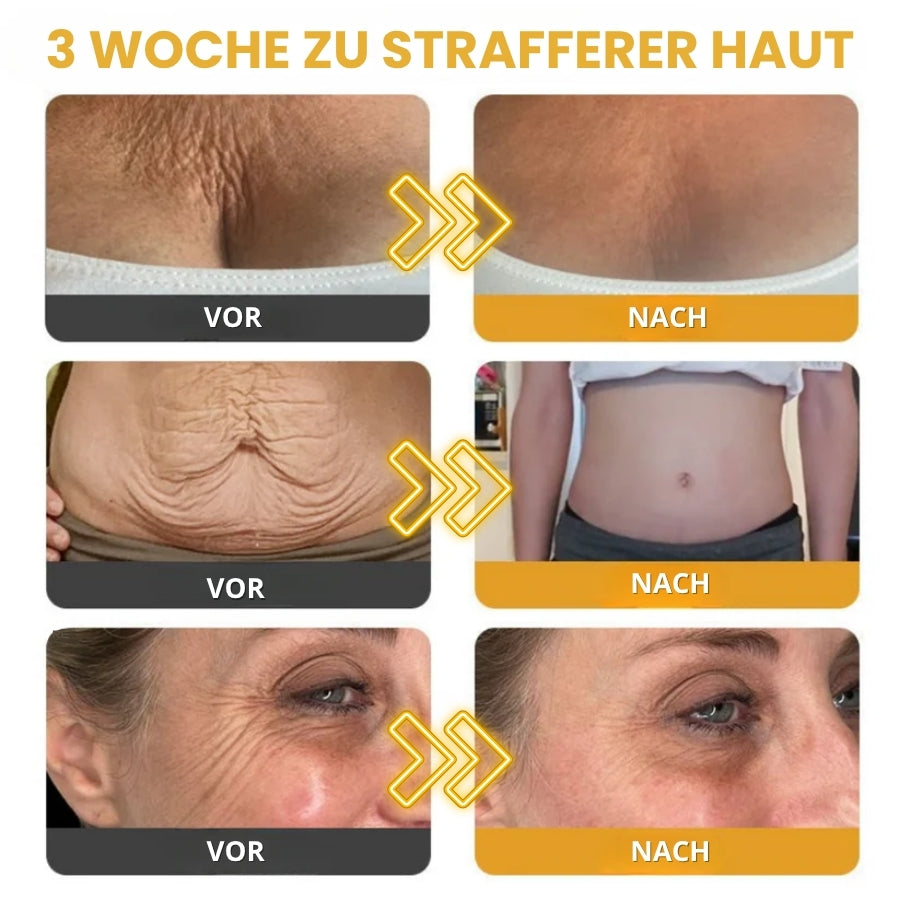 Venomé™ | Botox Faltenstraffende Creme