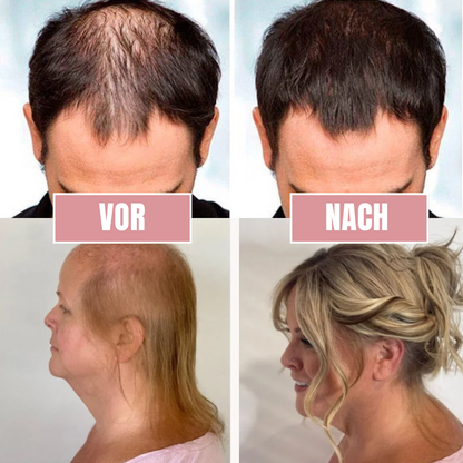 HairRevive™ | Reis-Nährstoff-Haarspray
