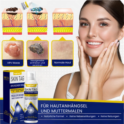 TagFree™ | Cryotherapie Hautanhängsel-Entferner-Spray