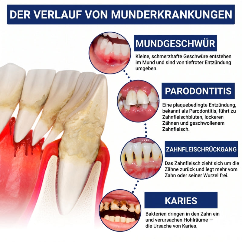 Balancia™ | Bienengift gegen Zahnfleischrückgang