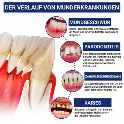 Balancia™ | Bienengift gegen Zahnfleischrückgang
