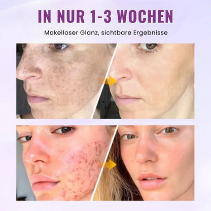 GlowGenix™ | Niacinamid Aufhellendes Sommersprossen Serum
