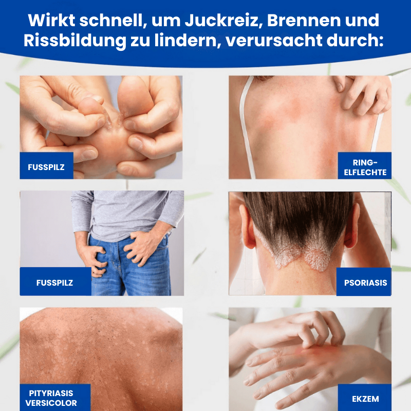 FungusFree™ | Antimykotische Creme