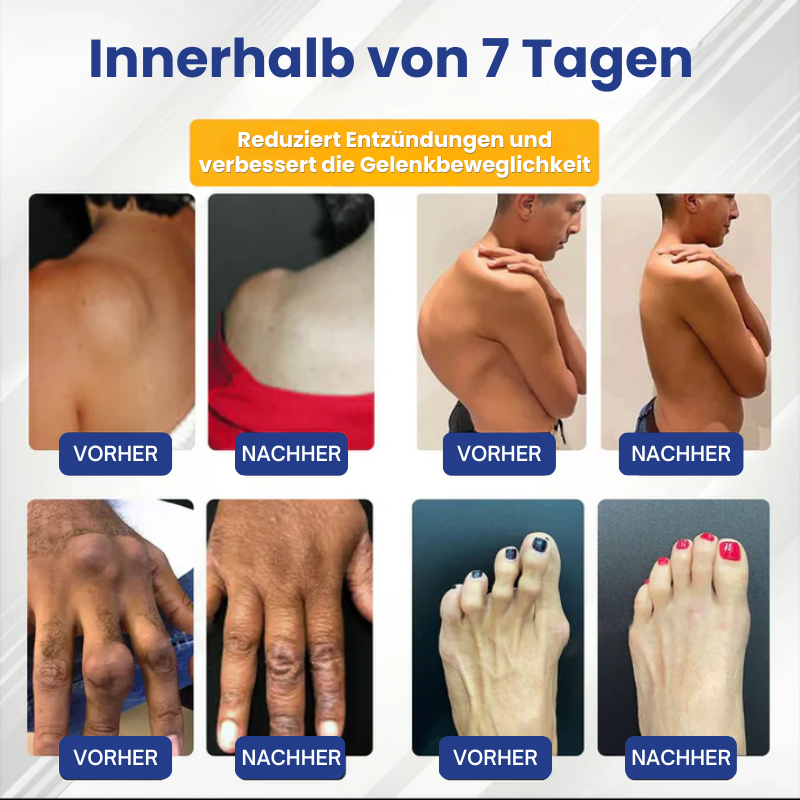 MoveFree™ | Motion+ Kräuter Gelenkkomfort Balsam