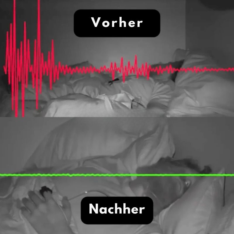 SleepEase™ | Anti-Schnarch & Schlafverbesserungs-Band