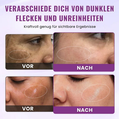 GlowGenix™ | Niacinamid Aufhellendes Sommersprossen Serum