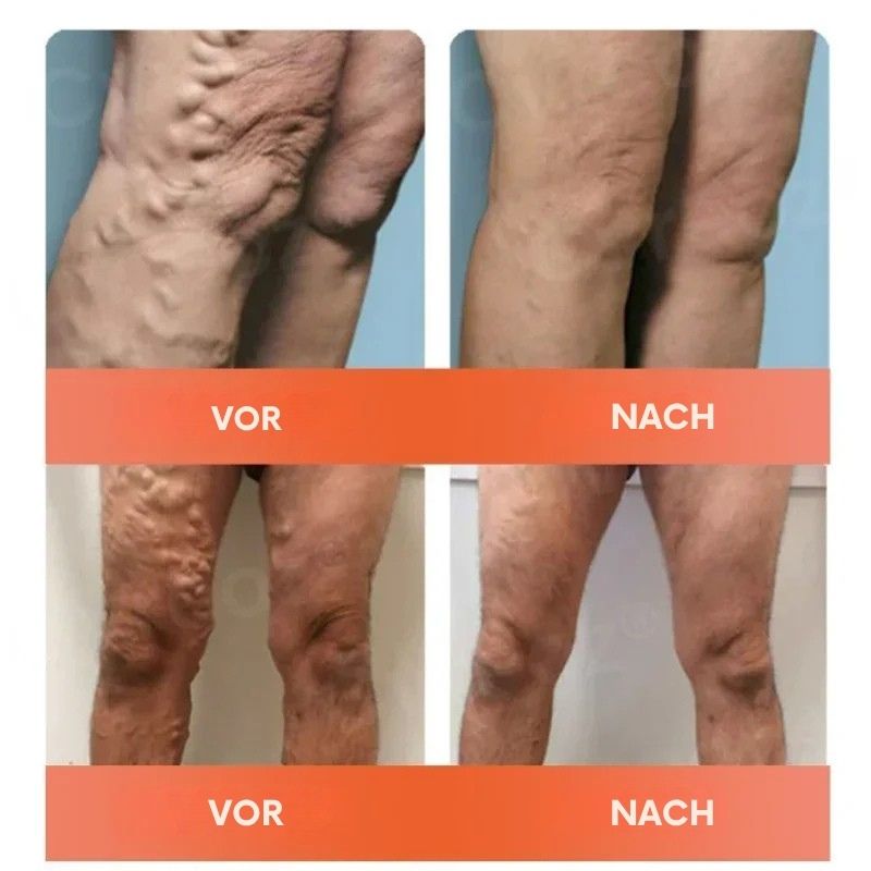 VitaVene™ | Natürliche Venenpflege-Kapseln