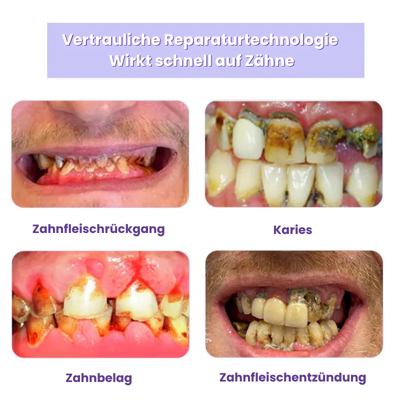 HydroDent™ | Beseitigt 97 % aller Karies und Zahnempfindlichkeit in nur 5 Tagen!