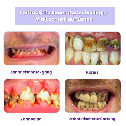 HydroDent™ | Beseitigt 97 % aller Karies und Zahnempfindlichkeit in nur 5 Tagen!